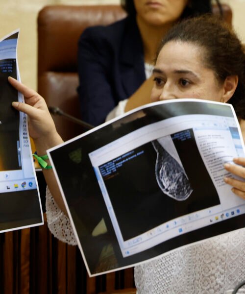 La Fiscalía de Andalucía abre diligencias sobre los fallos en el cribado del cáncer de mama en Andalucía
