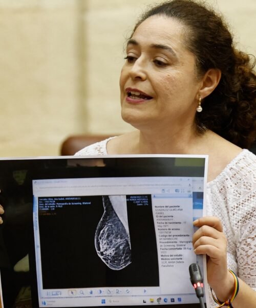 La Fiscalía de Sevilla también investiga la supuesta modificación de pruebas vinculadas al cribado del cáncer de mama
