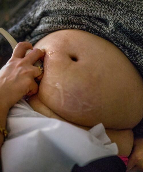 Igualdad propone demandar a las webs de vientres de alquiler señaladas por la Fiscalía