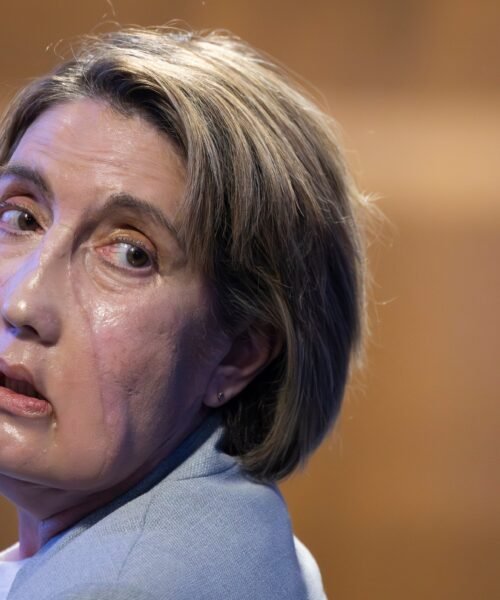 Vall d’Hebron realiza con éxito el primer trasplante de cara del mundo a partir de una donante que recibió la eutanasia