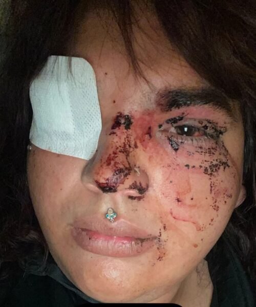 Una mujer trans sufre una paliza por parte de una decena de personas en un pueblo de León