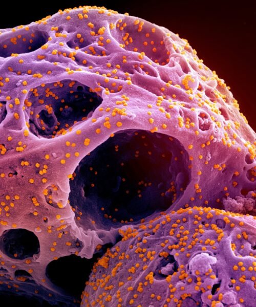 Un atlas de los virus respiratorios revela que la covid ya no es invernal y pone en cuestión el calendario vacunal